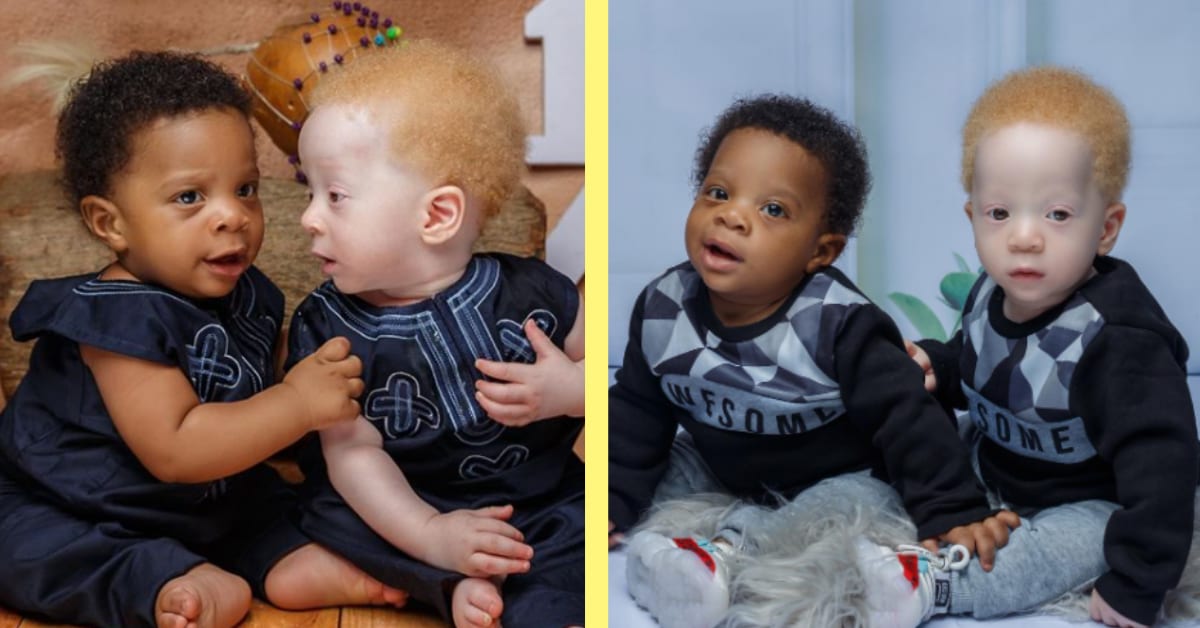 Twins Born With Different Skin Colors Leads to Wonderful Situation for